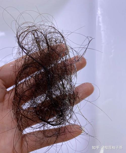 香港今晚开奖结果开奖记录和因发量太多剃掉头发与因发量太多剃掉头发会怎么样